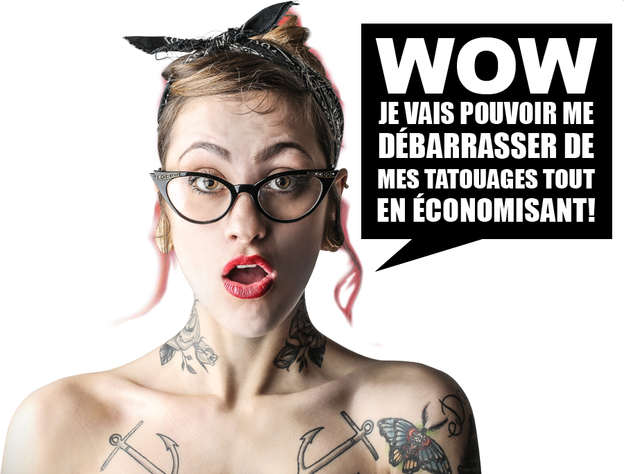 Détatouage